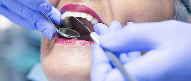 Best Urgent Care for Lost Fillings or Crowns in Gleason, TN